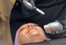 Lifting Supreme: La revolución del rejuvenecimiento sin cirugía llega a Morelia