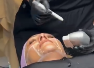 Lifting Supreme: La revolución del rejuvenecimiento sin cirugía llega a Morelia